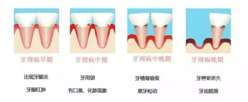 欧美人牙欧美人体生殖阴部结构与健康-第2张图片